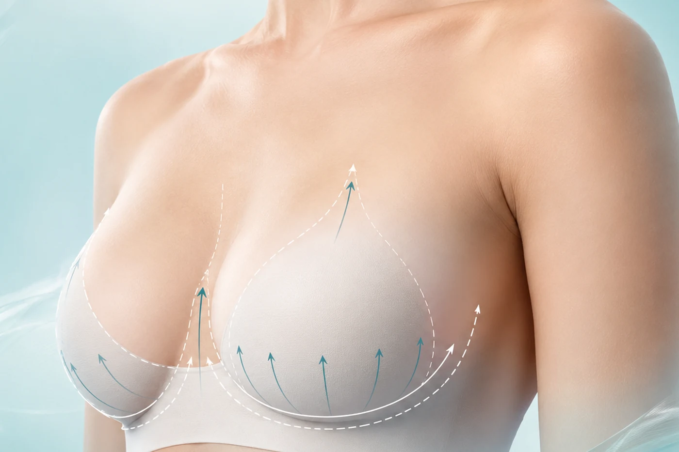Patient discussing breast lift, breast augmentation and combined surgery options with a plastic surgeon during a professional consultation.