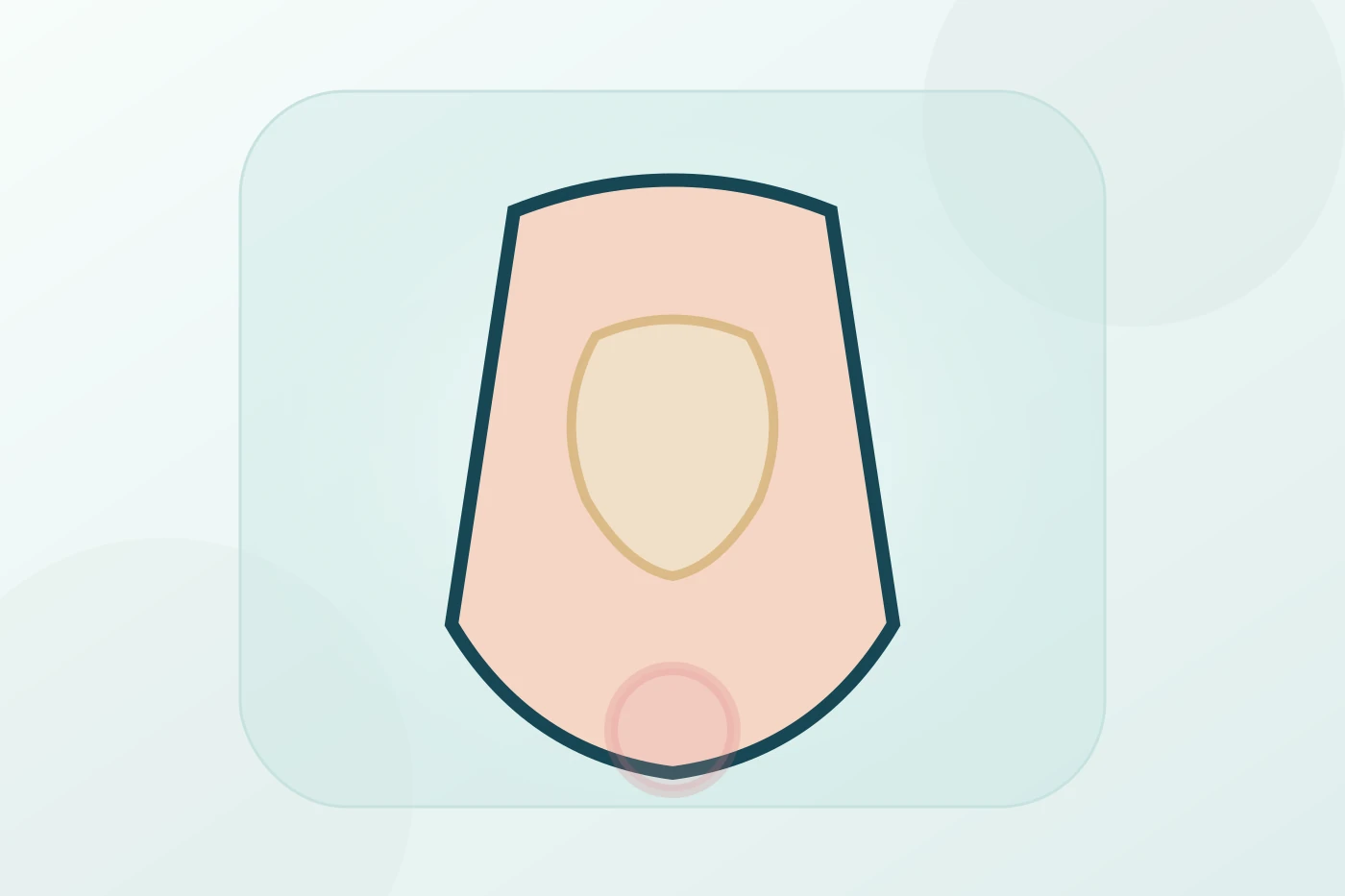 Doctor explaining hemorrhoid treatment options using an anatomical model to discuss internal and external hemorrhoids, banding, and surgical removal.