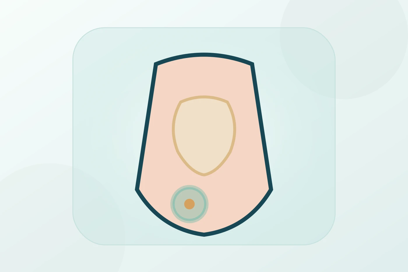 Patient discussing inguinal and umbilical hernia repair options with a surgeon using anatomical illustrations to explain hernia location and treatment planning.
