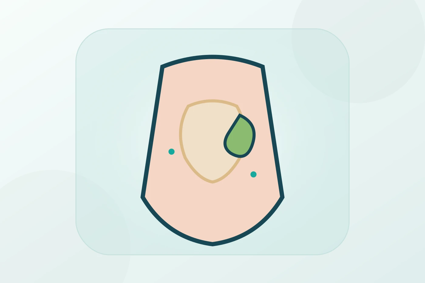 Patient discussing gallbladder removal with a surgeon using an anatomical model and medical imaging to explain gallstones and laparoscopic cholecystectomy planning.