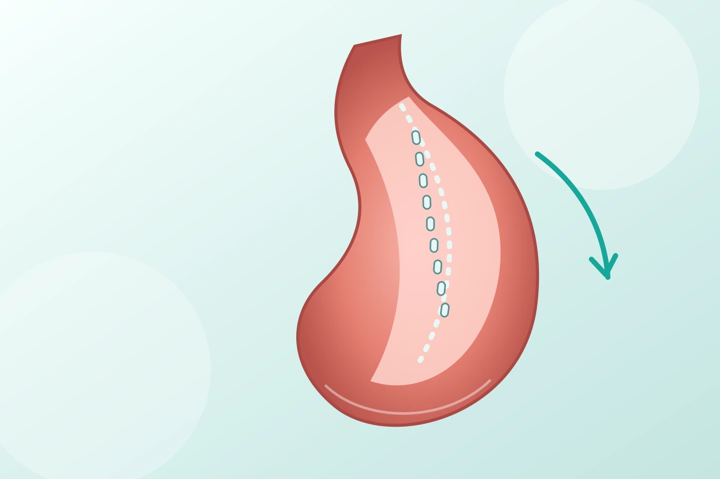 Patient reviewing the staged diet after gastric sleeve surgery, including clear liquids, full liquids, puréed foods, soft foods and gradual return to regular textures with a bariatric specialist.