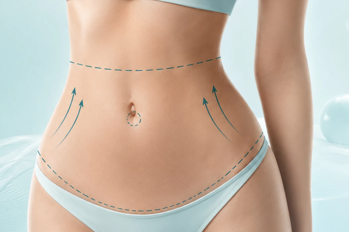Tummy tuck patient reviewing week-by-week recovery, compression garment use, swelling, mobility and gradual return to activity with a plastic surgeon.